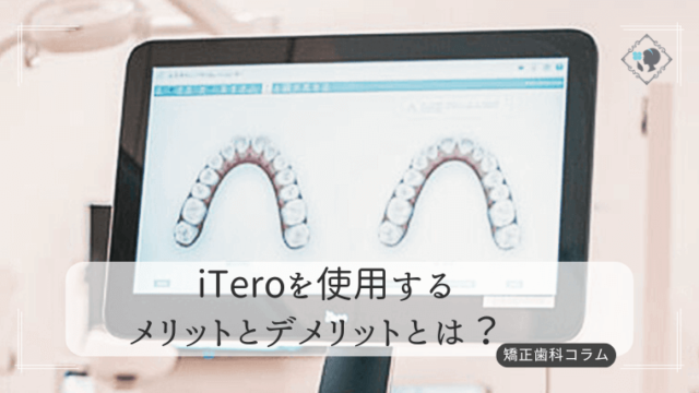 iTeroを使用するメリットとデメリットとは？