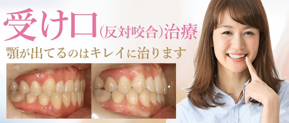 受け口、反対咬合の治療方法・治療例｜大阪矯正歯科グループ